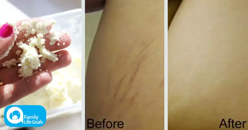 The science-backed reason Shea Butter may moisturize and heal your skin better than Coconut Oil
