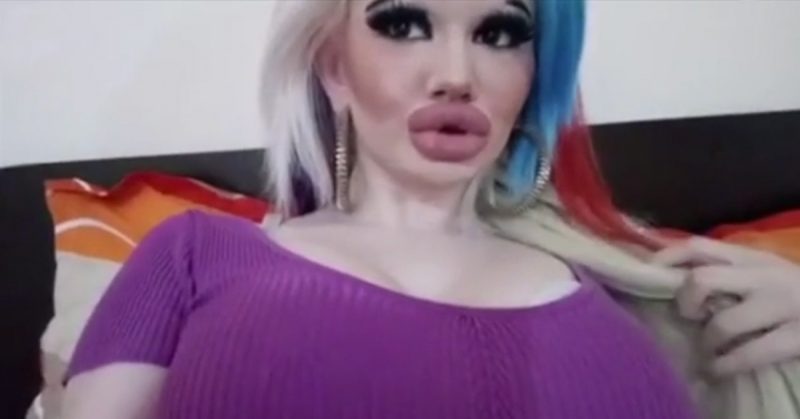 Woman spends thousands of dollars to triple the size of her lips, and still wants to make them bigger to appear ‘prettier’