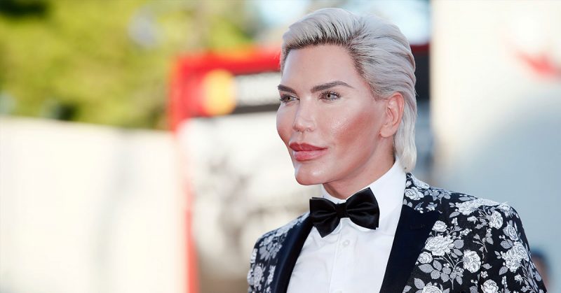 The Human Ken Doll Has Spent Over $750,000 On 72 Cosmetic Surgeries And Is At Risk