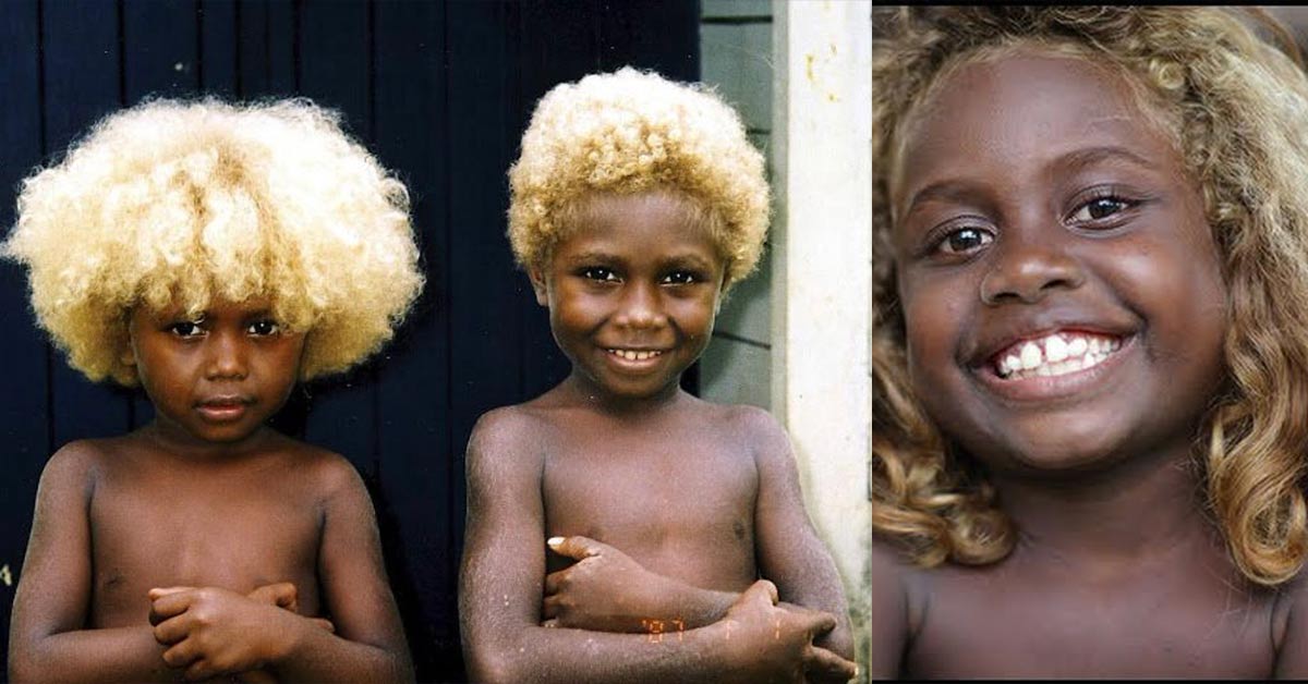 Meet the Melanesians, the Only Black People in the World with Natural Blond Hair