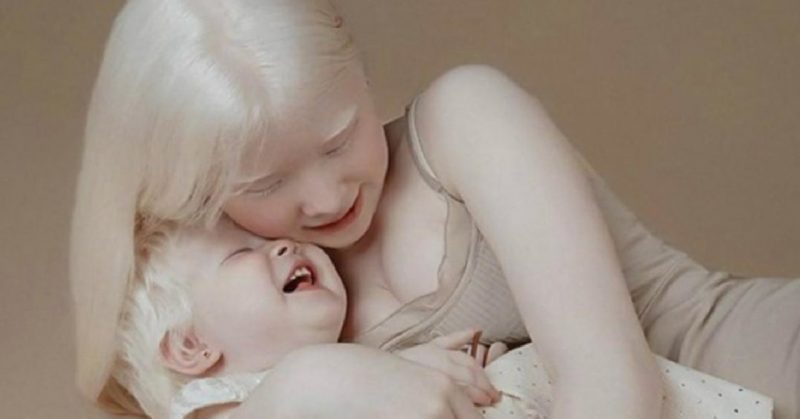 Stunning Albino Sisters Who Were Born 12 Years Apart Become Internet Sensations For Their Unique Appearance