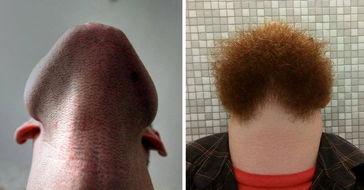 Hilarious Pictures of Bearded Men’s Chin-Up Selfies That Went Viral