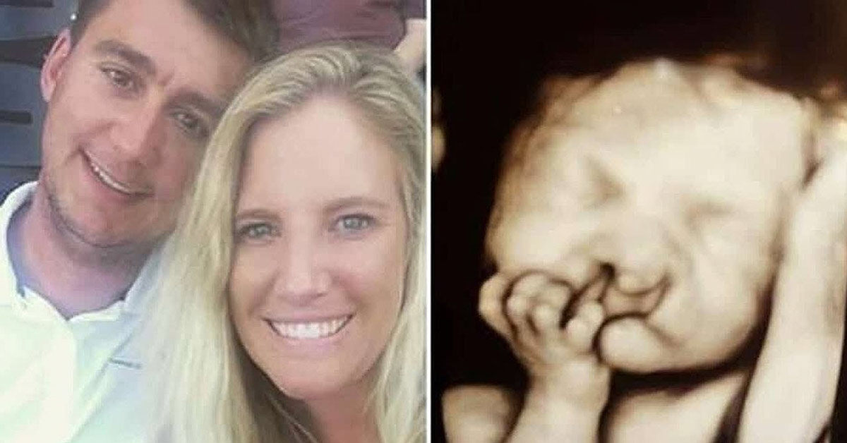 Parents Refuse to Abort Their ‘Deformed’ Baby — Just Look at Him 4 Years Later